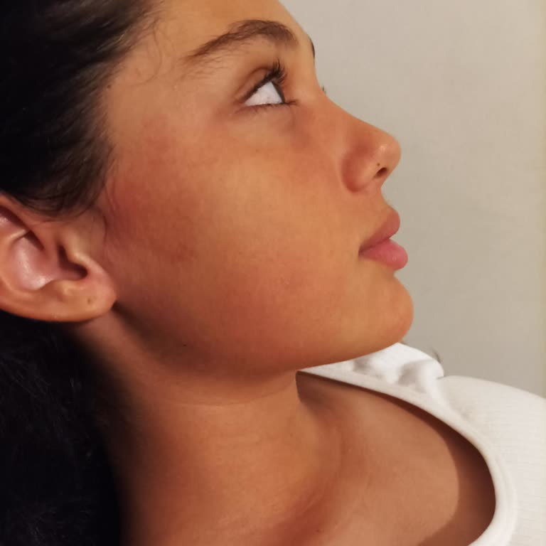 Nivea Revitalizing Face Wash Caused Redness and Swelling After First Use