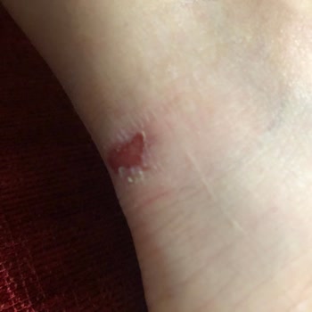 SuperStep'ten Aldığım Adidas Ayakkabı Ayaklarımı Kanattı