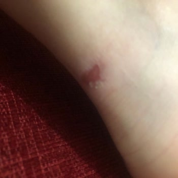 SuperStep'ten Aldığım Adidas Ayakkabı Ayaklarımı Kanattı