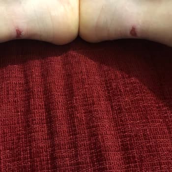 SuperStep'ten Aldığım Adidas Ayakkabı Ayaklarımı Kanattı