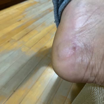 Asics Gel Kayano 30 Topukta Su Toplama