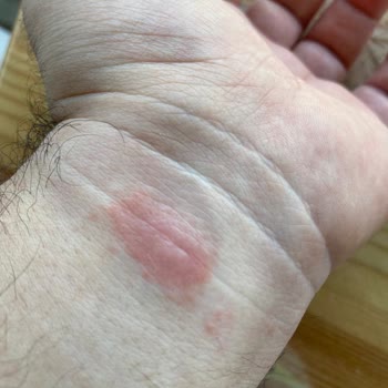 Irritación con Apple Watch 7 Nike 41 Banda