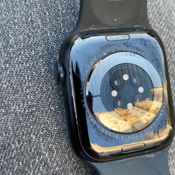 Mi Apple Watch 7 se está pelando después de solo 10 meses