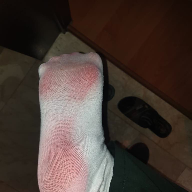 Crocs Terlik & Ayakkabı Crocs Çoraplarımızı Boyadı, Gönderdik Ürünlerinin Arkasında Durmadılar