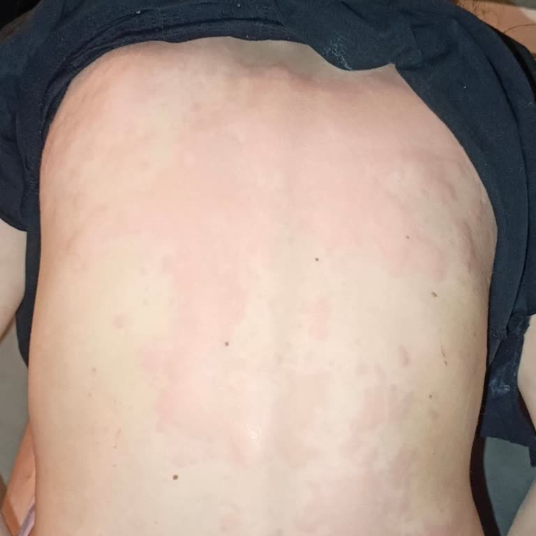Argivit Plus Alerjik Durumu