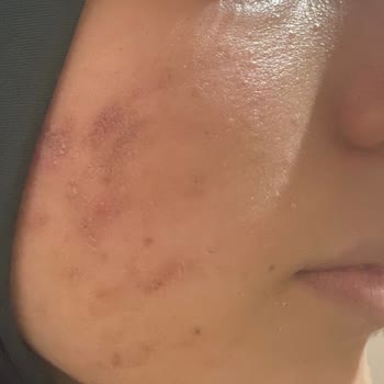 Estelina Güzellik Merkezi Para Avı Hatalı Merkez