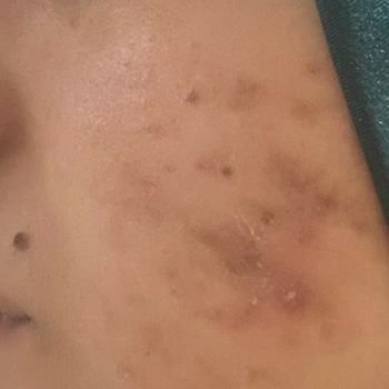 Estelina Güzellik Merkezi Para Avı Hatalı Merkez