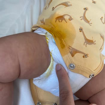 Prima Bebek Bezi Sızdırma Problemi