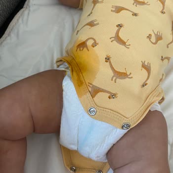 Prima Bebek Bezi Sızdırma Problemi