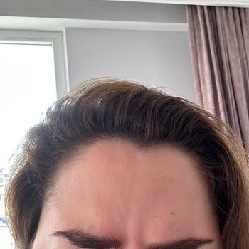 Özel Zen Poliklinik Botoks Pişmanlık Zen Poliklinik