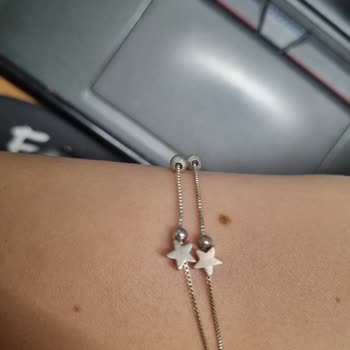 Pür Takı Aldığım Gümüş Bileklik Karardı Ve Müşteri Hizmetleri Cevap Vermiyor