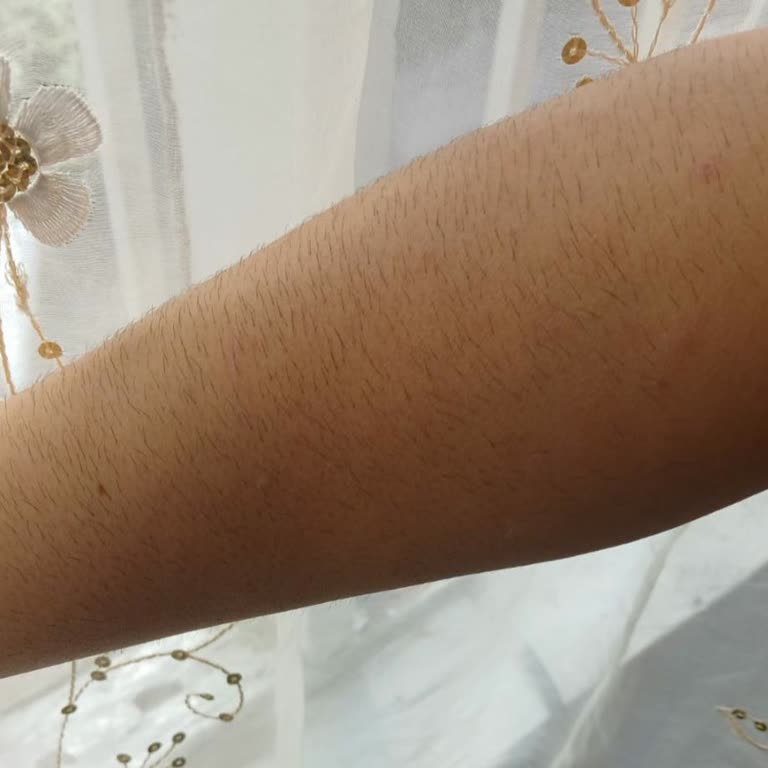 Anka Güzellik Aldatıcı Hizmet Ve Kötü Muamele: Epilasyon Salonunda Hayal Kırıklığı