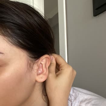 Quartz Clinique Kepçe Kulak Ameliyatı