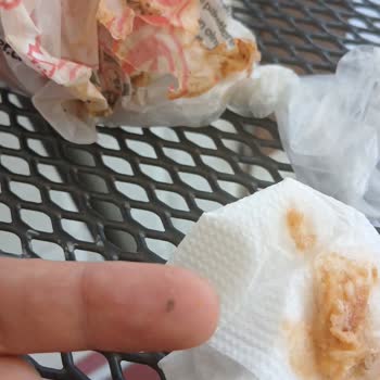 Öncü Döner Siparişimden Cam Parçası Çıktı