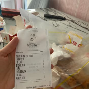 Sr Döner Dönerin İçinden Tüy Çıktı