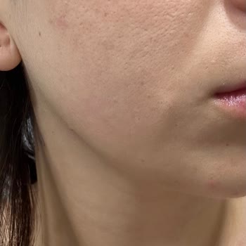 Yves Rocher Yüzüm Millia Doldu Gündüz Kremi Yüzünden