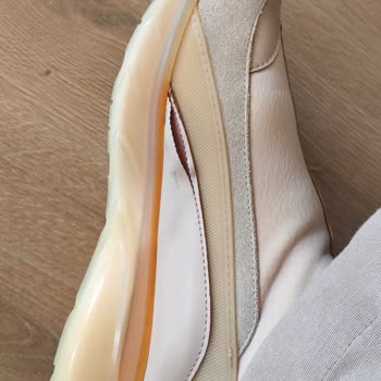 Serkan Kundura İndirimli Üründe Kalite Sorunu Ve İlgisiz Hizmet