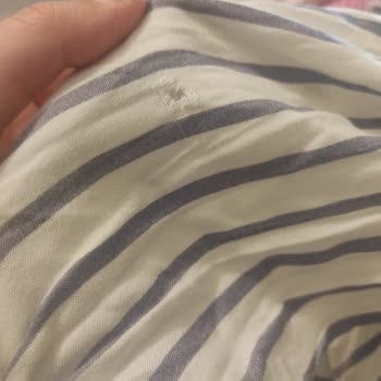 Gardrops Ürün Yırtık Geldi