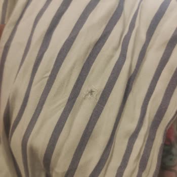 Gardrops Ürün Yırtık Geldi