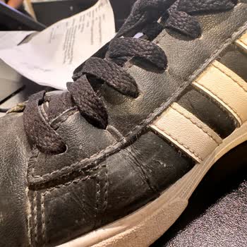 Adidas Ayakkabım Kısa Sürede Yırtıldı Ve İnceleme Red Verildi!