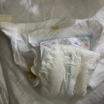 Prima Premium Care Sızdırma Sorunu.
