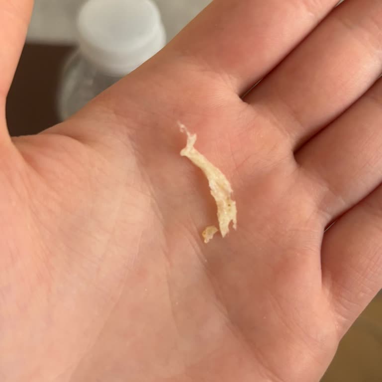 Ülker Altınbaşak Cipsten Çıkan Plastik Benzeri Parça