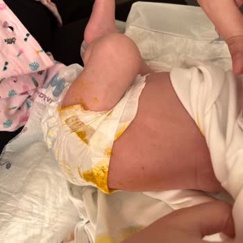 Molfix 1 Numara Bez Dışına Çıkarıyor