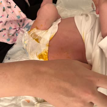 Molfix 1 Numara Bez Dışına Çıkarıyor