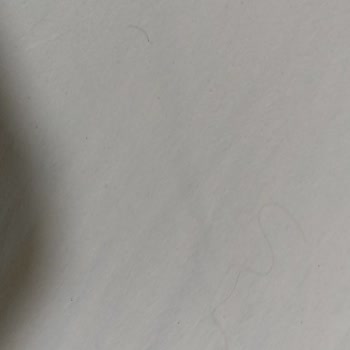 İnci-Hamitcan Aksoy Sürmene Öğretmenevi Sağlığınızı Tehlikeye Atan Kötü Konaklama Deneyimi