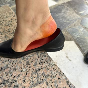 Derimod Ta Deri Olduğu İçin Boyar Saçmalığı