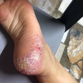 Derimod Ta Deri Olduğu İçin Boyar Saçmalığı