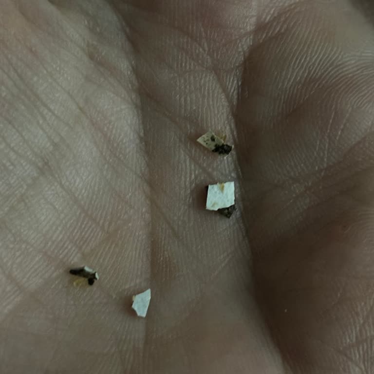 İnci Mantı Markalı Mantı Ürününde Beklenmedik Parçalar