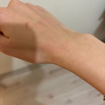 Palette Markalı Boyanın Ciltte Bıraktığı Hasar Üstelik Uyarı Vs Yok