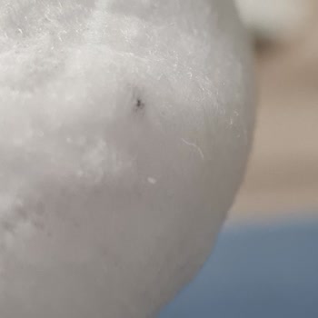 Sleepy Bebek Bezi İçerisinde Siyah Bir Şeyler