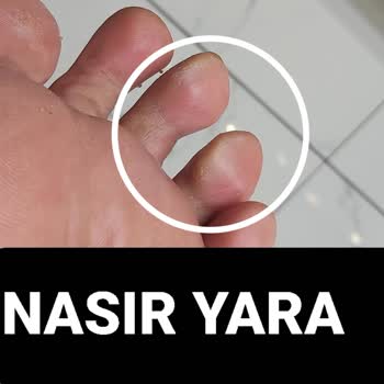 Eki aç