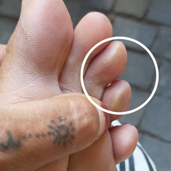 Skechers Plastik Terlik Çok Kötü Yaptı Ayağımın Altını Üstünü Çok