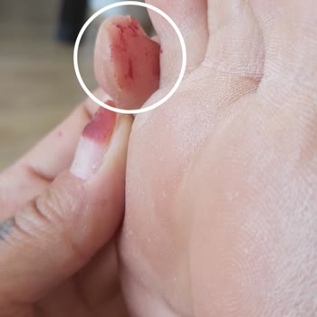 Skechers Plastik Terlik Çok Kötü Yaptı Ayağımın Altını Üstünü Çok