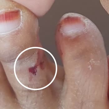 Skechers Plastik Terlik Çok Kötü Yaptı Ayağımın Altını Üstünü Çok