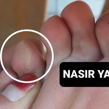 Skechers Plastik Terlik Çok Kötü Yaptı Ayağımın Altını Üstünü Çok