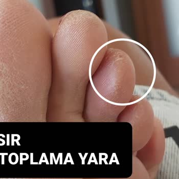 Skechers Plastik Terlik Çok Kötü Yaptı Ayağımın Altını Üstünü Çok