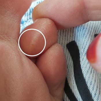 Skechers Plastik Terlik Çok Kötü Yaptı Ayağımın Altını Üstünü Çok