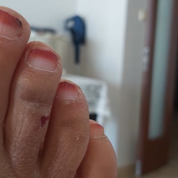 Skechers Plastik Terlik Çok Kötü Yaptı Ayağımın Altını Üstünü Çok