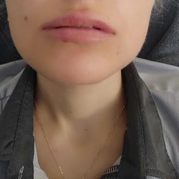 Eki aç