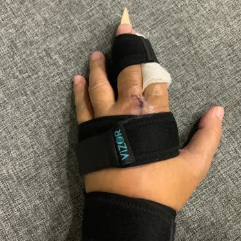 Etenna Beach Bungalows Hastane Masraflarımı Öde!