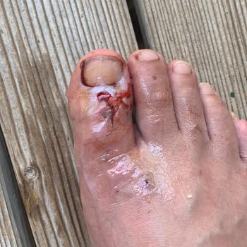 Etenna Beach Bungalows Hastane Masraflarımı Öde!