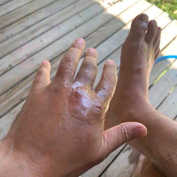 Etenna Beach Bungalows Hastane Masraflarımı Öde!