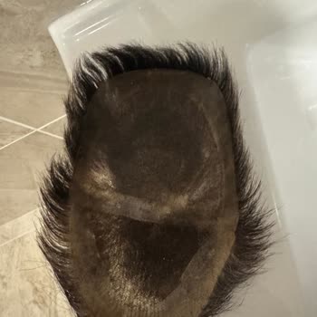 Hairplus Kadıköy Protez Saç Merkezi'nde Büyük Hayal Kırıklığı