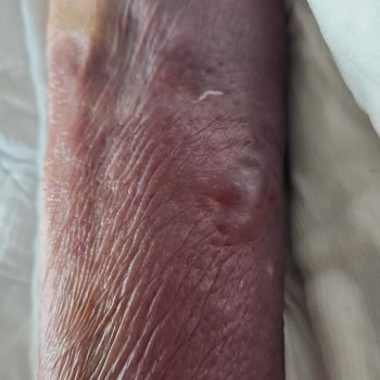 Koç Üniversitesi Hastanesi Hastaya Kötü Muamele