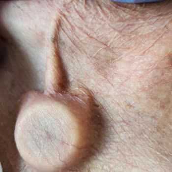 Koç Üniversitesi Hastanesi Hastaya Kötü Muamele