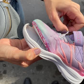 SKETCHERS'IN Ürün Kalitesizliği Ve Seri Müşteri Mağduriyeti